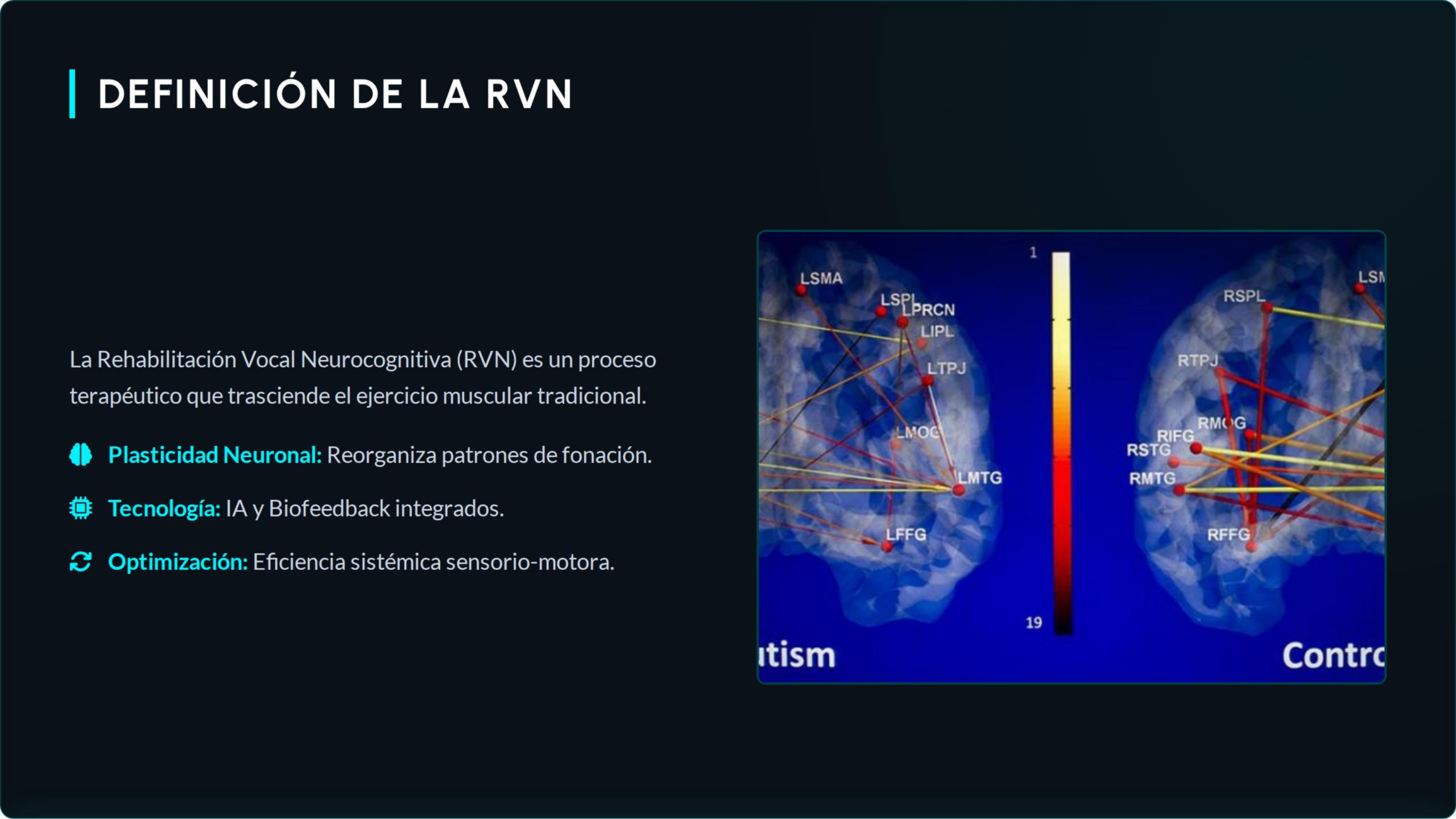 Que es la RVN?